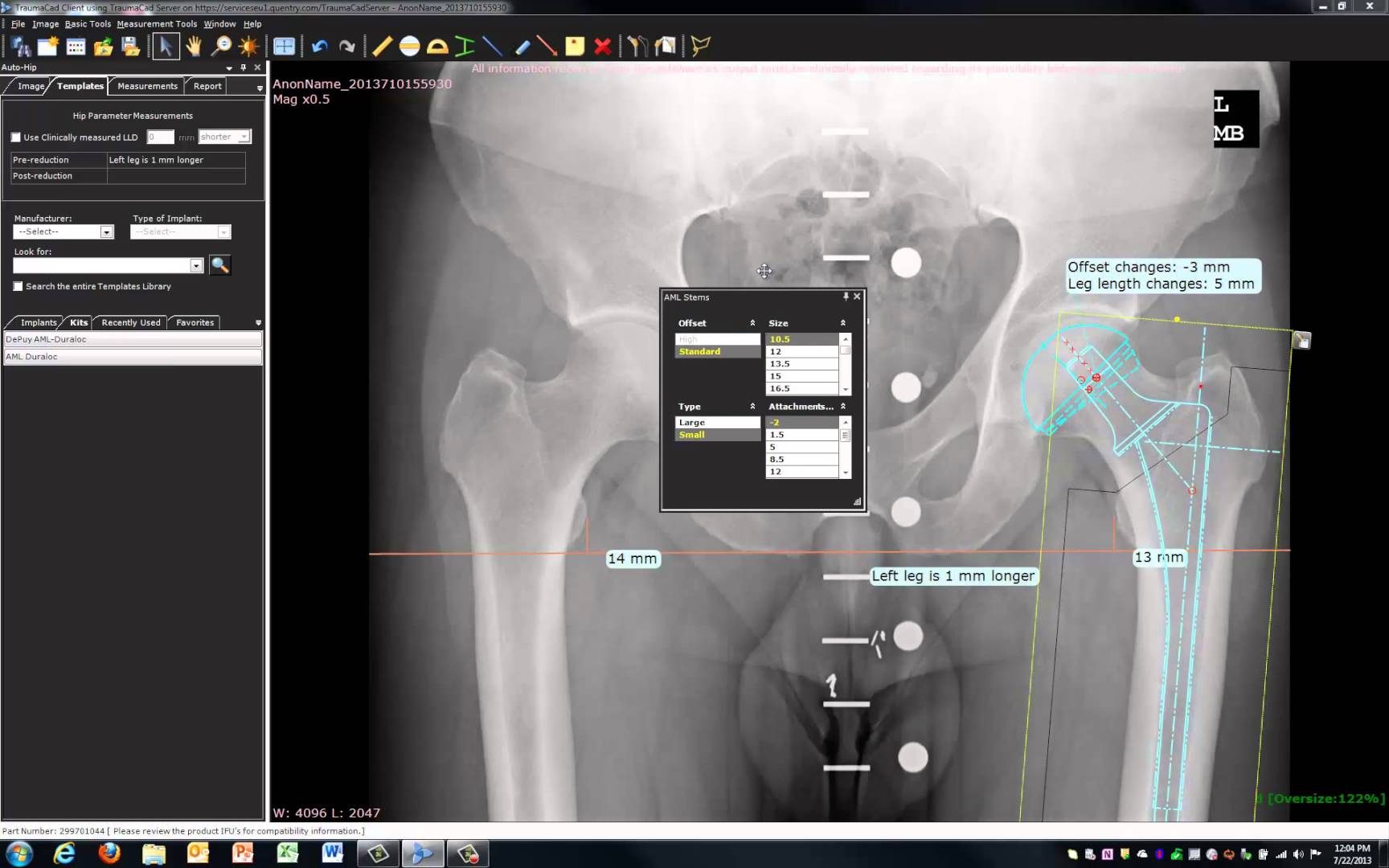 X-ray of a pelvis