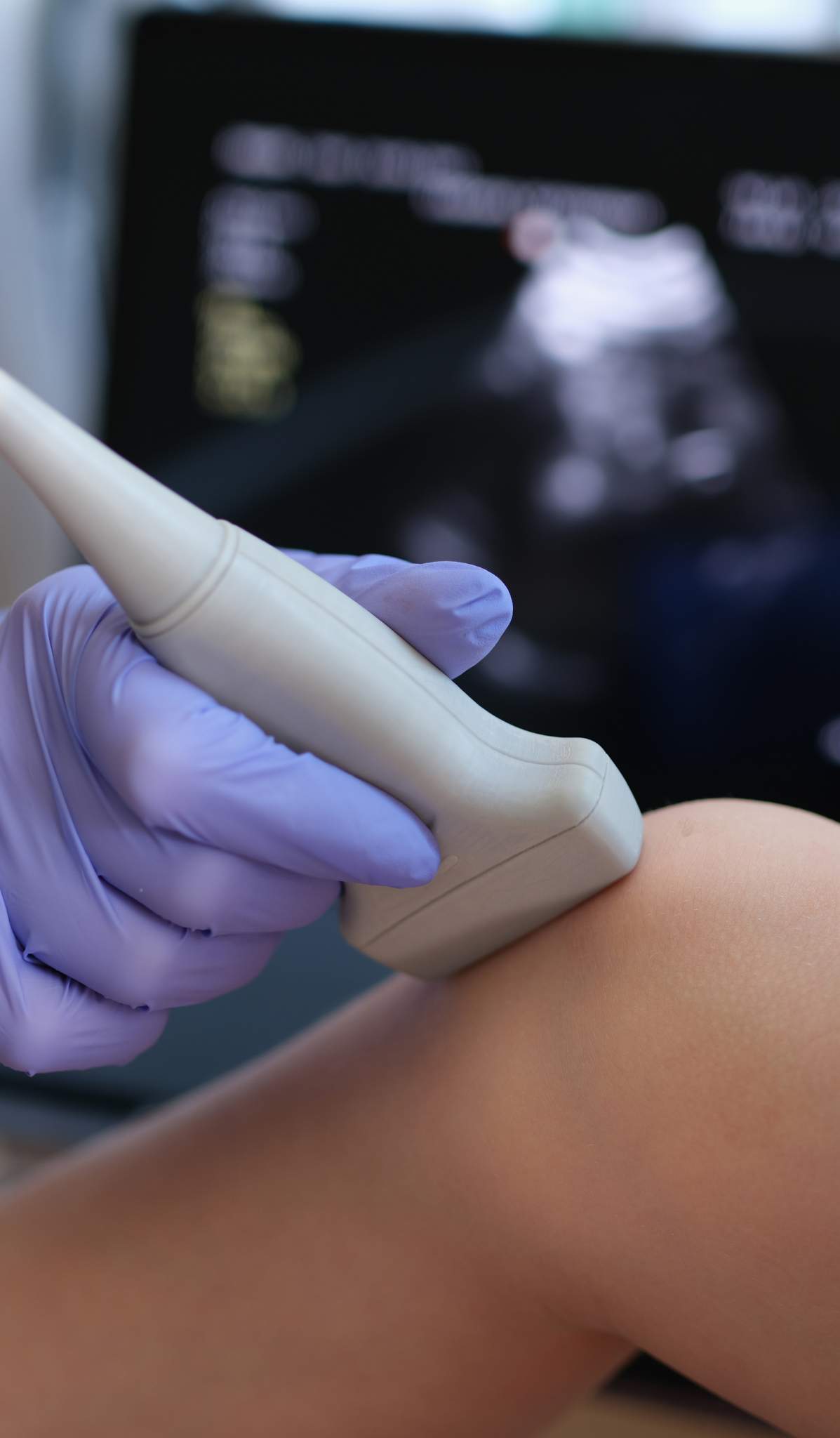 Knee ultrasound