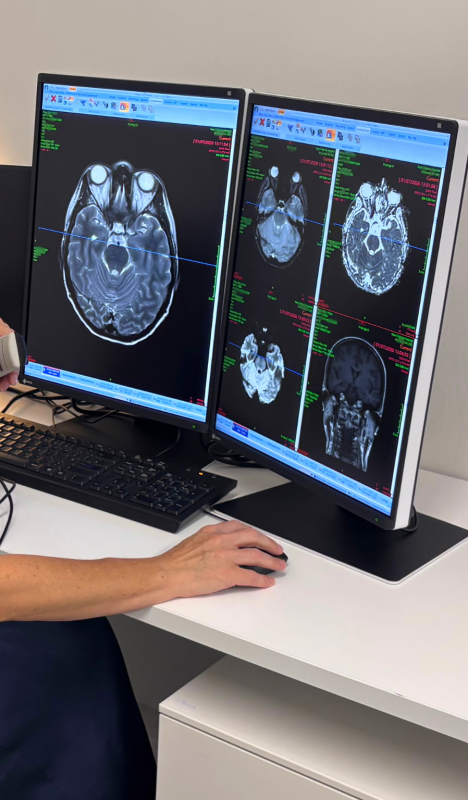 MRI Brain Scan imaging